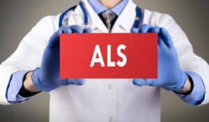 Home Care Cockeysville MD - Symptoms Of ALS for Seniors And Their Families